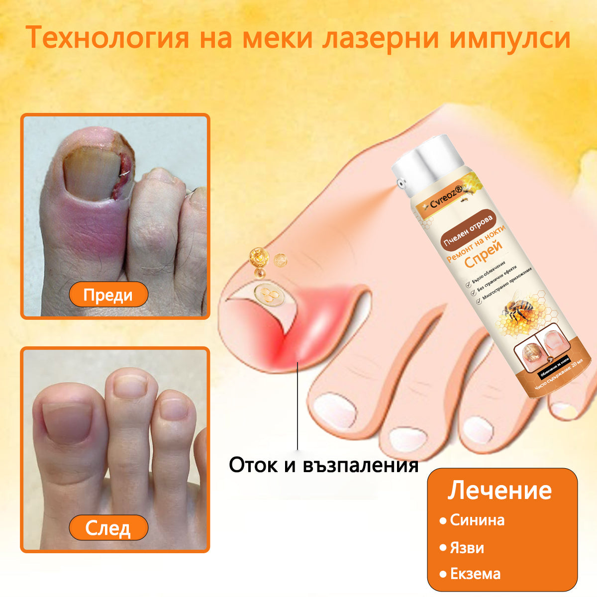 Cvreoz® 🛡️Спрей с пчелна отрова ⏳Унищожава бактериите за 1 минута, почти пълно възстановяване само след 2 седмици