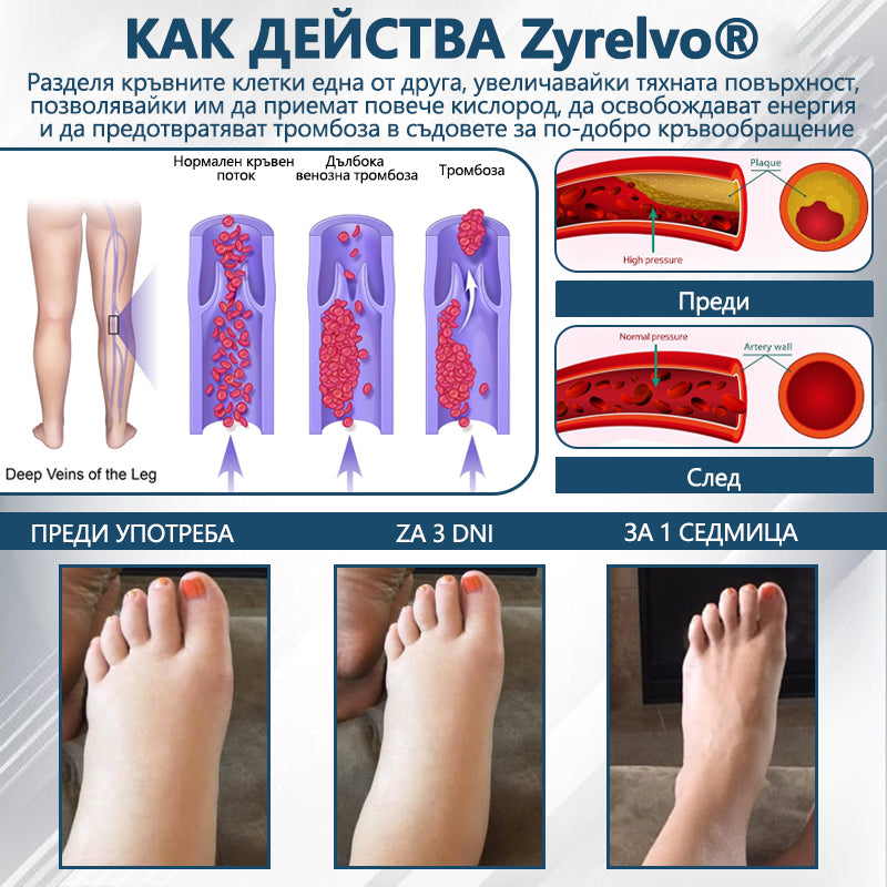 💧XaltraX®🌲 Билков успокояващ крем против отоци с черен кимион