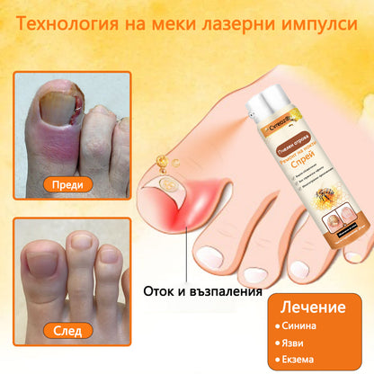 Cvreoz® 🛡️Спрей с пчелна отрова ⏳Унищожава бактериите за 1 минута, почти пълно възстановяване само след 2 седмици