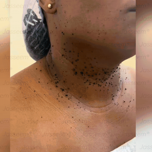 𝐉𝐚𝐬𝐬𝐞𝐞𝐦®✅ Усъвършенствана неинвазивна CO₂ лазерна писалка за грижа за кожата 💕(Нежно и ефективно премахва брадавици, бенки, старчески петна и кожни образувания – без болка и без усилие!)