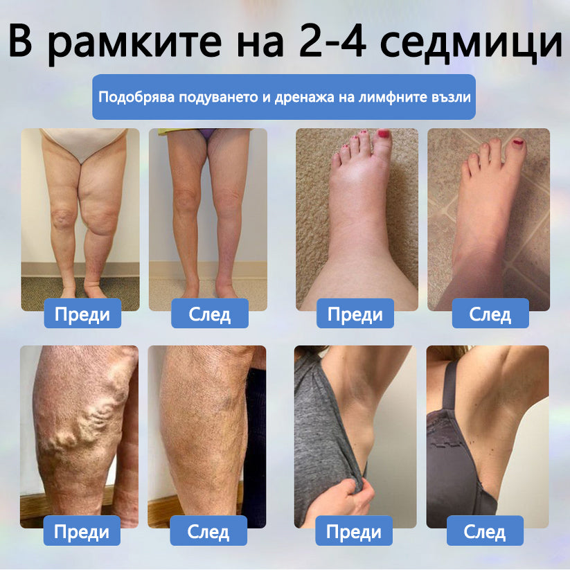 💧XaltraX®🌲 Билков успокояващ крем против отоци с черен кимион