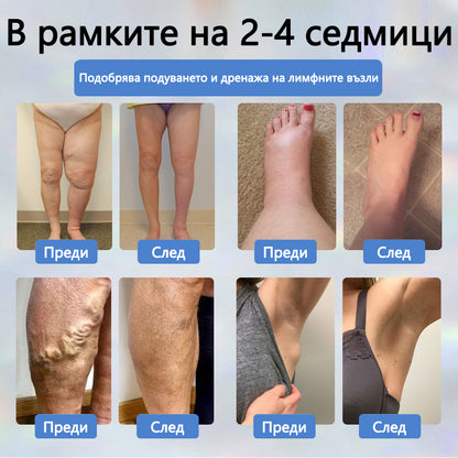 💧ATTDX® Билков успокояващ крем против отоци с черен кимион