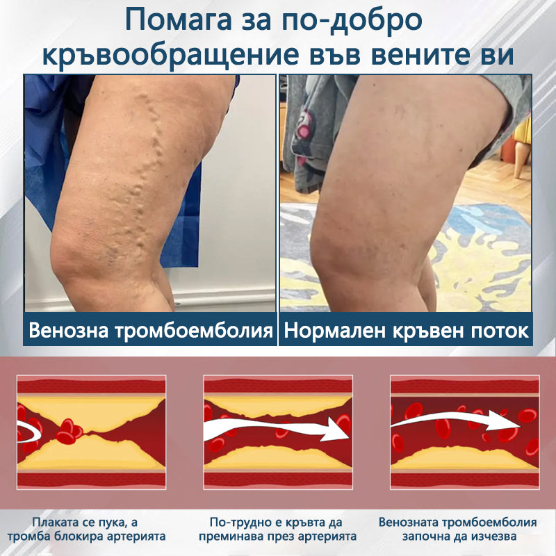 💧XaltraX®🌲 Билков успокояващ крем против отоци с черен кимион